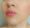 results after face lift threads