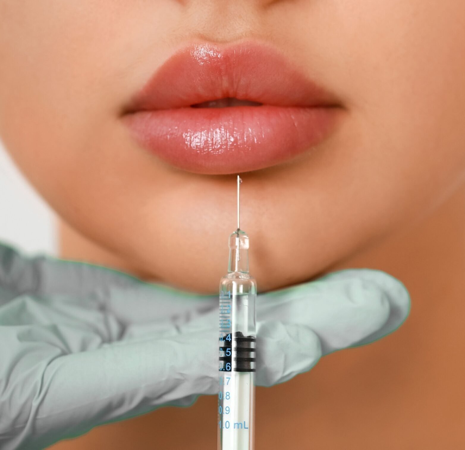 proalign face & smile lip augmentation