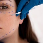 Non-Surgical Facelift in Dubai